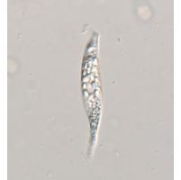 Astasia harrisii
