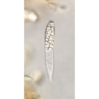 Astasia praecompleta