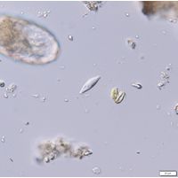 Sphenomonas teres