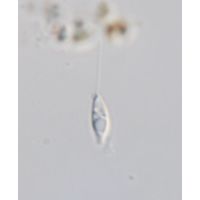 Sphenomonas teres