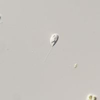 Sphenomonas teres