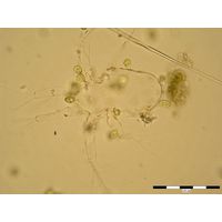 Colacium cyclopicola