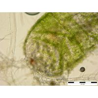 Colacium cyclopicola