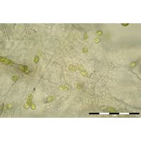 Colacium cyclopicola