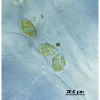 Colacium cyclopicola
