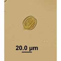Phacus monilatus