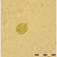 Phacus monilatus