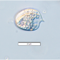 Phacus ocellatus