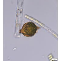 Strombomonas acuminata