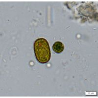 Trachelomonas abrupta