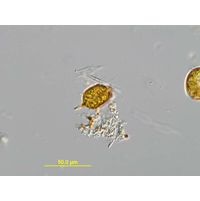 Strombomonas acuminata