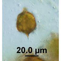 Strombomonas acuminata