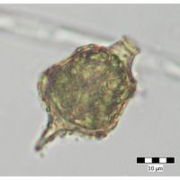 Strombomonas acuminata