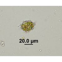 Strombomonas acuminata