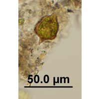 Strombomonas acuminata