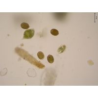 Trachelomonas hispida