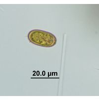 Trachelomonas abrupta
