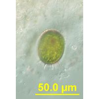 Trachelomonas armata