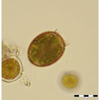 Trachelomonas armata