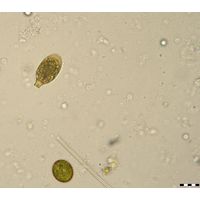 Trachelomonas bulla
