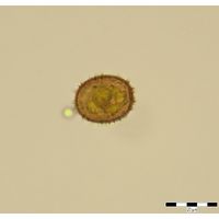 Trachelomonas