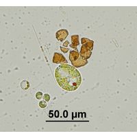 Trachelomonas