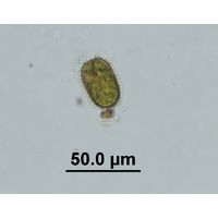 Trachelomonas superba