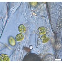 Colacium cyclopicola