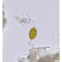 Trachelomonas caudata