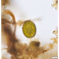 Trachelomonas superba