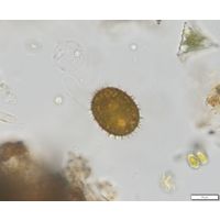 Trachelomonas superba
