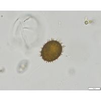 Trachelomonas superba