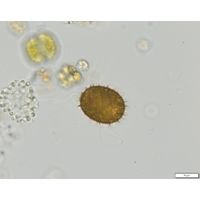 Trachelomonas superba