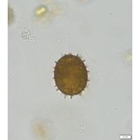 Trachelomonas superba