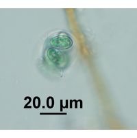 Glaucocystis nostochinearum
