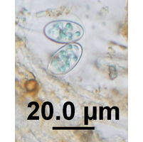 Glaucocystis nostochinearum