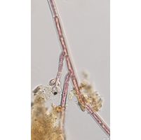 Audoinella hermanii
