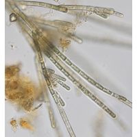 Audouinella pygmaea