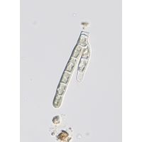 Audouinella pygmaea