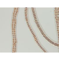 Bangia atropurpurea