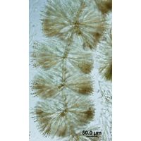 Batrachospermum gelatinosum