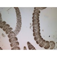 Batrachospermum gelatinosum