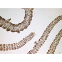 Batrachospermum gelatinosum