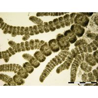 Batrachospermum gelatinosum