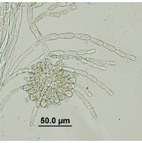 Batrachospermum gelatinosum