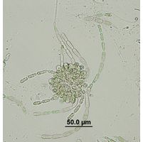 Batrachospermum gelatinosum