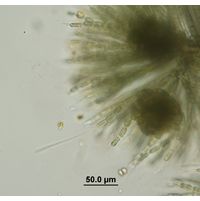 Batrachospermum gelatinosum