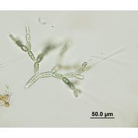Batrachospermum gelatinosum