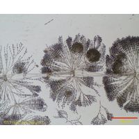 Batrachospermum