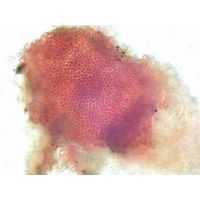 Hildenbrandia rivularis
